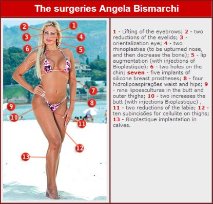 http://www.worldmeets.us/images/Angela-Bismarchi-plastic-surguries_pic.jpg
