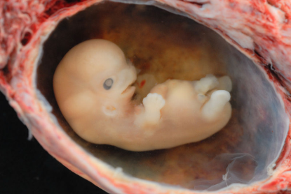 http://www.worldmeets.us/images/Human_Embryo-8-weeks_pic.png